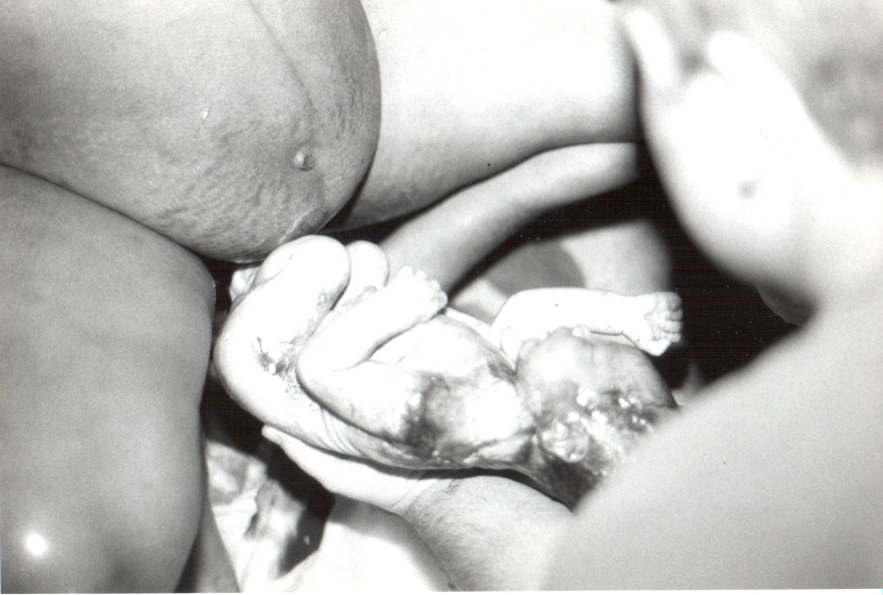 Homebirth